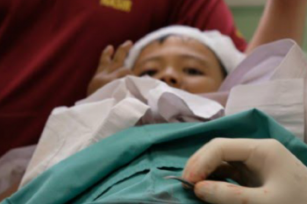 Manfaat Kesehatan Tindakan Sunat pada Anak