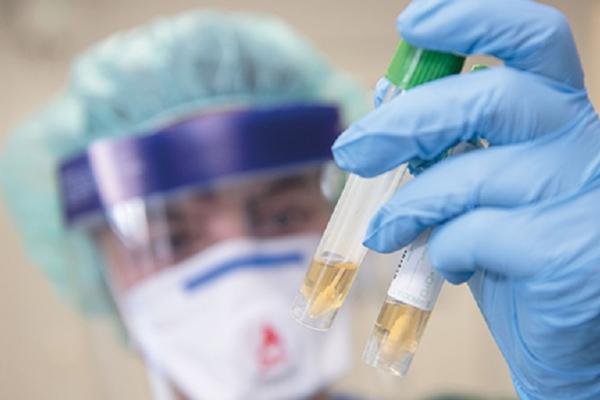 Dua Obat Antimalaria Digunakan untuk Pasien Virus Corona