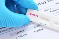 Dari 20.532 Rapid Test DKI, 2,1 Persen Positif Covid-19