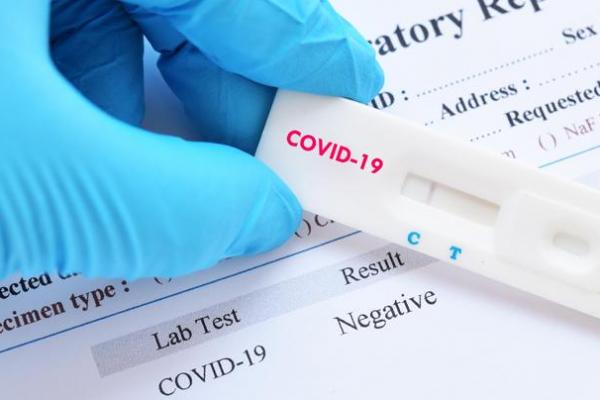  Penumpang Dibebani Biaya Tes  Covid, DPR Angkat Bicara 