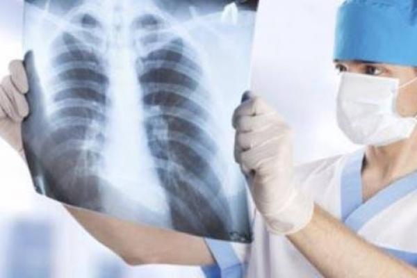 Covid-19 Berdampak pada Penurunan Layanan Penyakit TBC