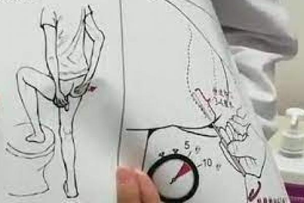 Melancong ke China Kini Harus Tes Usap Anal Untuk Deteksi Covid-19