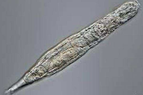 Makhluk Miskroskopis Ini Hidup Kembali Setelah Membeku 24.000 Tahun di Siberia