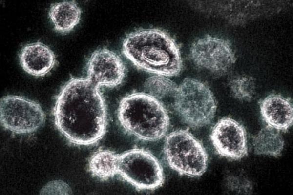 WHO: Pembuktian Omicron Sebabkan Penyakit Lebih Parah akan Makan Waktu Beberapa Minggu