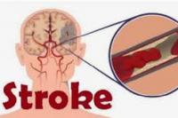 Hati-Hati! Ini Gejala Stroke