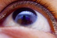 Mengenal Buta Warna Parsial, Kenali Jenis dan Cara Mengatasinya Jika Mengalami Gejala