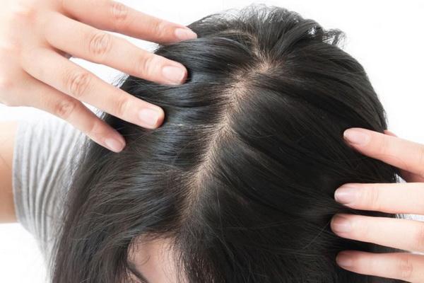 5 Bahan Alami untuk Atasi Rambut Rontok, Beserta Caranya