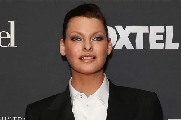 Supermodel Linda Evangelista Menyesal Tubuhnya Rusak akibat Operasi CoolSculpting