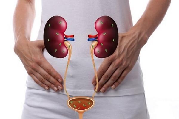 Hindari Kebiasaan Sehari-hari yang Bisa Picu Infeksi Saluran Kemih