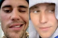 Justin Bieber Beri Kabar Terbaru Mobilitas Wajahnya akibat Sindrom Ramsay Hunt