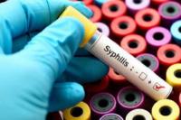 Data Kemenkes, Ini Kelompok  Tertinggi Terinfeksi Sifilis