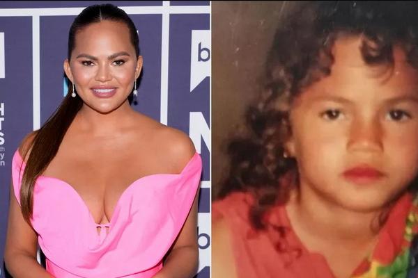 Chrissy Teigen Bagikan Foto Kenangan Wajah Imut Masa Kecil, Begini Komentar John Legend