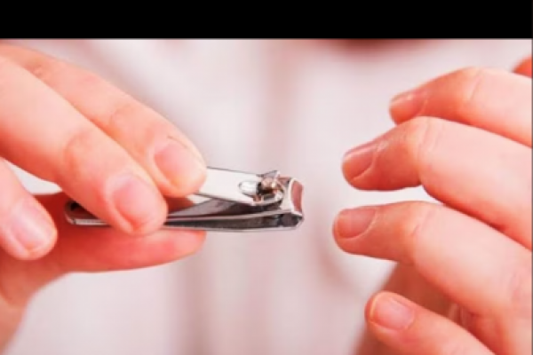 Ingat, Jangan Potong Kuku dan Rambut Kalau Mau Kurban