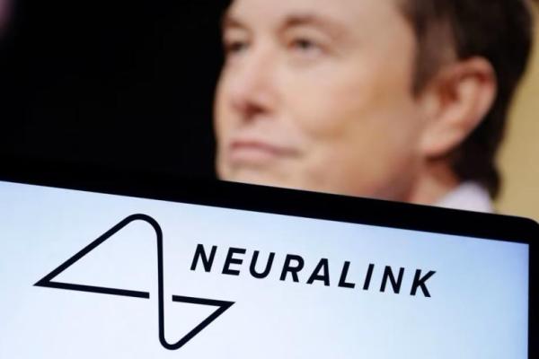 Neuralink Milik Musk Segera Uji Coba Implan Otak Manusia pada Pasien Lumpuh