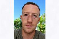Latihan Jiu Jitsu, Mark Zuckerberg Perlihatkan Dua Matanya yang Lebam