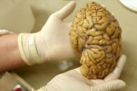 Teliti Detail Otak Manusia, Ilmuwan Berhasil Identifikasi 3.300 Sel Baru