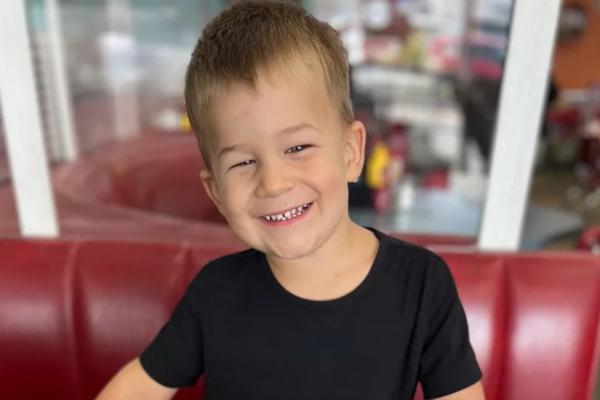 Baru Ditinggal Sebentar Sang Ayah, Balita Disengat Lebih dari 20 Lebah