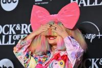 Sia Mengaku Operasi Sedot Lemak untuk Menurunkan Berat Badan