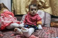 Kisah Sedih Balita di Gaza, Selamat dari Pemboman Israel Tapi Kehilangan Keluarga dan Tangannya