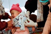 Sepuluh Ribu Anak Terancam, Dokter di Gaza Tangani Malnutrisi di Tenda Pengungsi