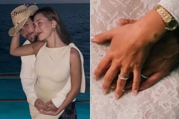 Umumkan Kehamilan, Justin Bieber dan Hailey Bieber Pakai Cincin Kawin Berlian Tiffany (FOTO:HAILEY BIEBER/INSTAGRAM; RORY KRAMER) 