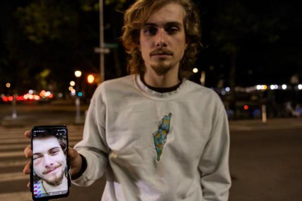 Seorang mahasiswa Pascasarjana Union Theological Seminary memegang telepon yang memperlihatkan foto patah tulang orbital, di New York City, New York, AS, 11 Mei 2024. REUTERS 