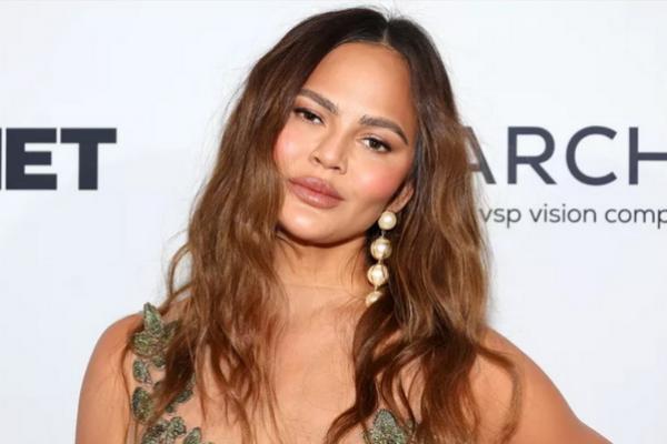 Chrissy Teigen Kesal Dituduh Suntik Filler di Wajahnya