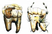 Daging Tidak Ada dalam Menu Nenek Moyang Manusia Australopithecus