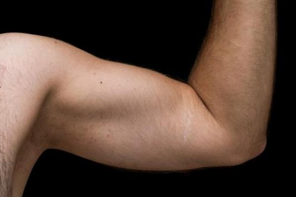 Inilah Efek Buruk Mencukur Bulu Ketiak