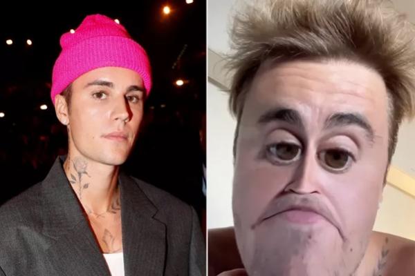 Justin Bieber Unggah Topik Random, Bukti Kesehatan Mentalnya Terganggu?