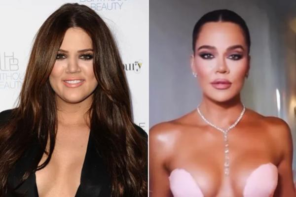 Makin Tambah Cantik, Berikut Operasi Plastik yang Dilakukan Khloe Kardashian. (FOTO: GETTY/INSTAGRAM) 