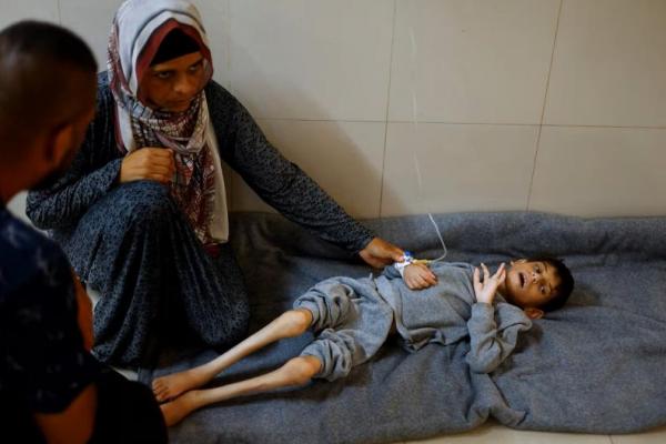Seorang ibu Palestina, Ghaneyma Joma, duduk di samping putranya yang kekurangan gizi, Younis Joma, di Rumah Sakit Nasser di Khan Younis, Jalur Gaza selatan, 8 Juli 2024. REUTERS 