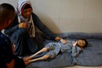 Gaza Kehabisan Makanan Khusus untuk Selamatkan Anak-Anak Malnutrisi