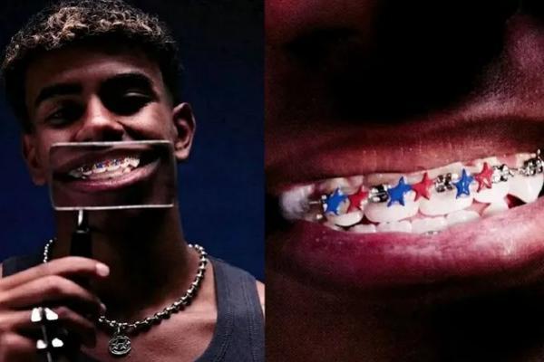 Ilustrasi - Kawat gigi penyerang Barcelona, Lamine Yamal (Foto: Screenshoot Instagram) 