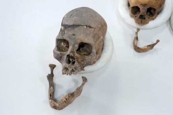 Tengkorak dan rahang bawah manusia diletakkan di atas meja laboratorium di Universitas Nasional, setelah para ilmuwan mengurutkan DNA sisa-sisa purba tersebut, di Bogota, Kolombia, 21 Agustus 2025. REUTERS 