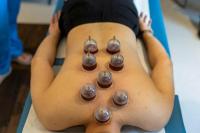 Bekam, Lintah, dan Metode Penyembuhan Kuno Disambut Baik di RS Turki