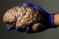 Inilah Makanan yang Baik untuk Kesehatan Otak, Catat Ya!