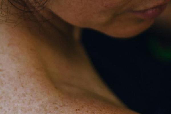 Ilustrasi jerawat punggung (Foto: Unsplash/Sam Badmaeva) 