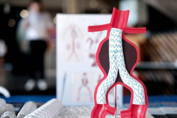 Ilustrasi - Hari Kesadaran Diseksi Aorta Sedunia setiap 19 September (Foto: iStockphoto) 