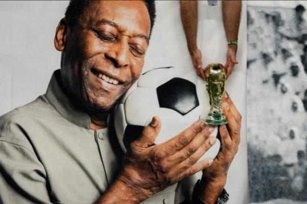 Derita Bronkopneumonia, Legenda Sepak Bola Brasil Pele Imbau Penggemar Tetap Positif