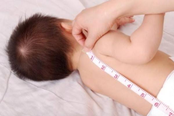 Miris, Setiap Tahun Lahir 400 Ribu Bayi Stunting 