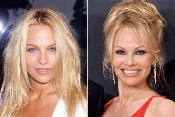 Jadi Simbol Seksi di Tahun 90-an, Pamela Anderson Ungkap soal Penuaan yang Dialaminya